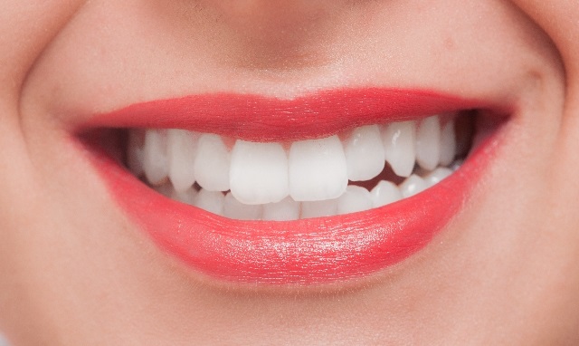 白い歯はとても魅力的